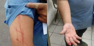 Nuevo ataque a chofer de colectivo durante intento de robo